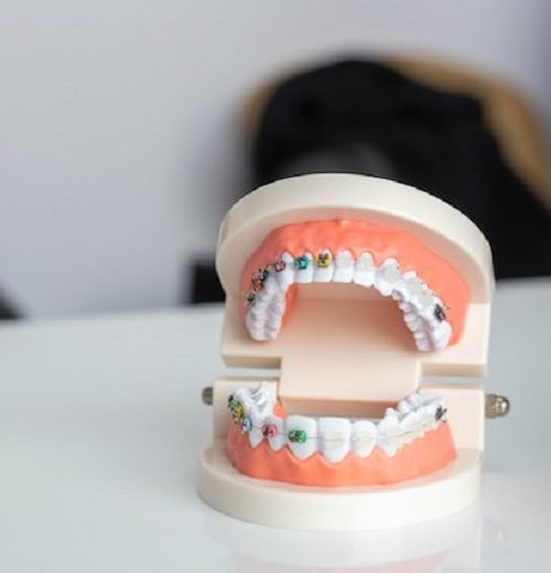 Why a Bite Adjustment Requires a Visit to an Orthodontist