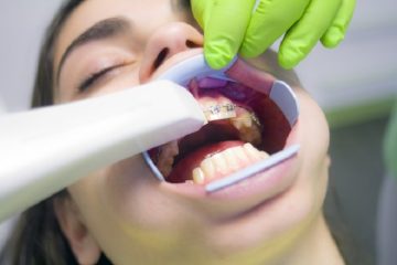 7 Benefits of Sedation Dentistry for Better Patient Experience